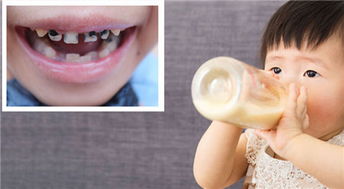 乳牙期口腔護理的重要性 別讓疏忽影響恒牙健康